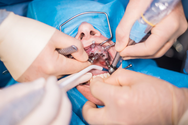 Maxillofacial Surgery