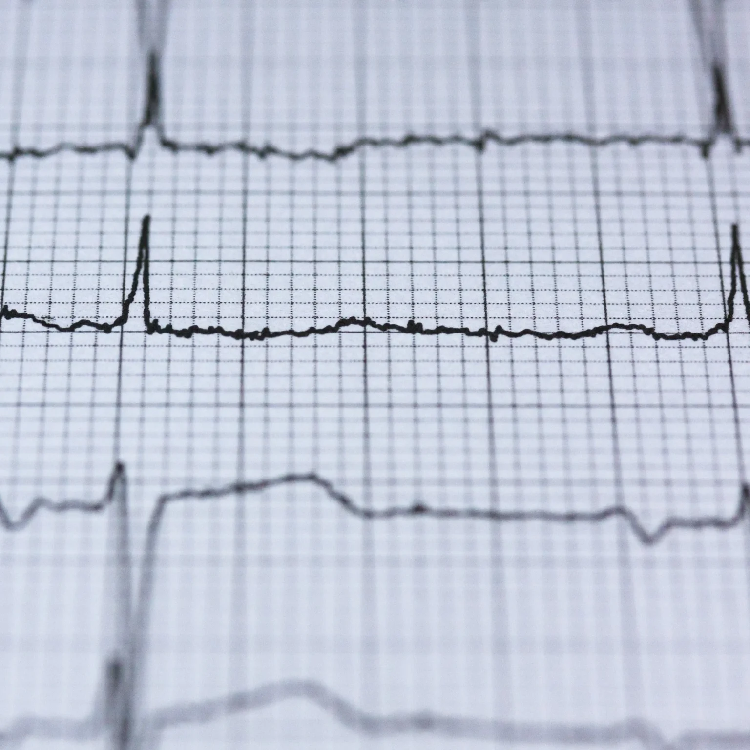 Cardiology
