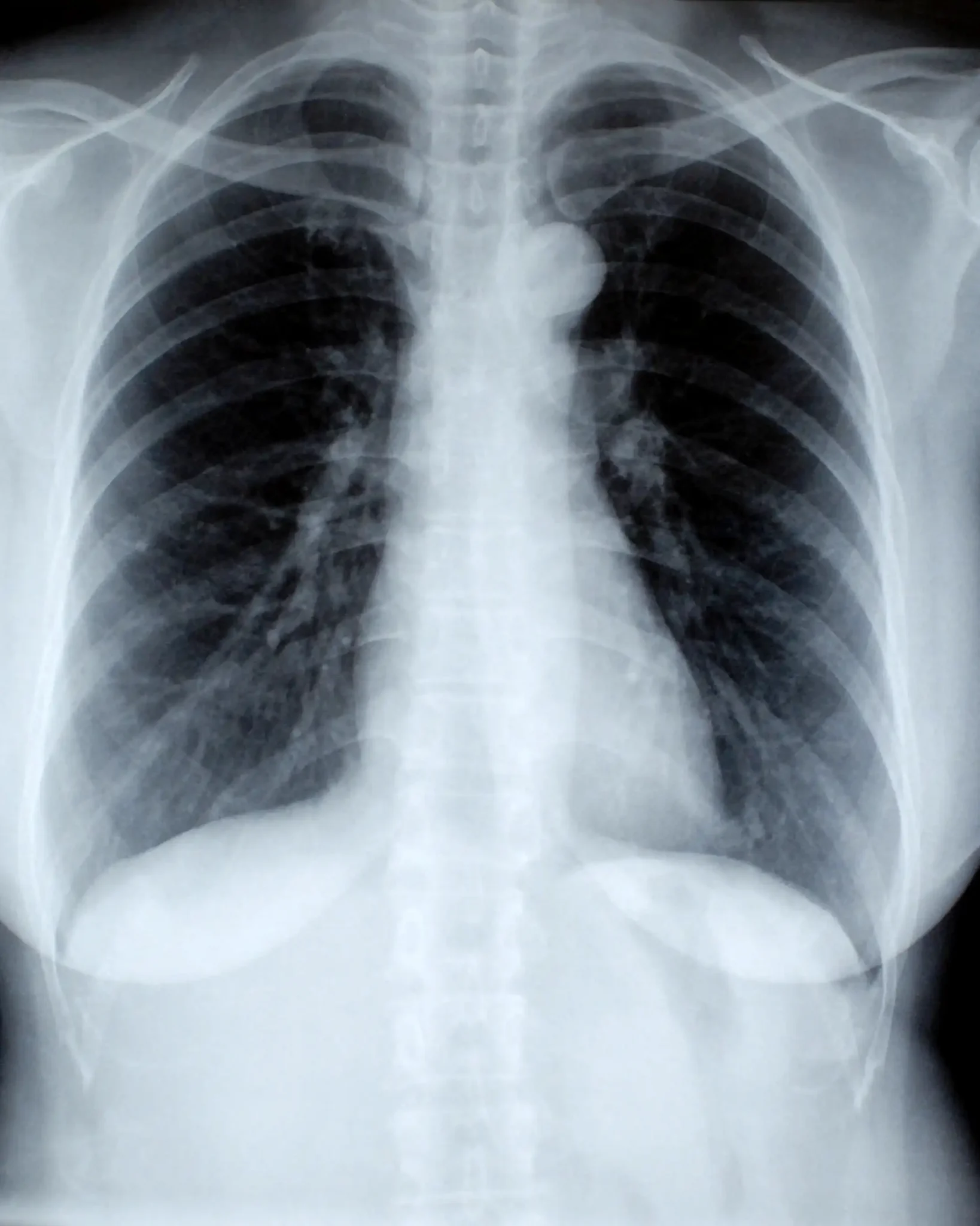 Pulmonology